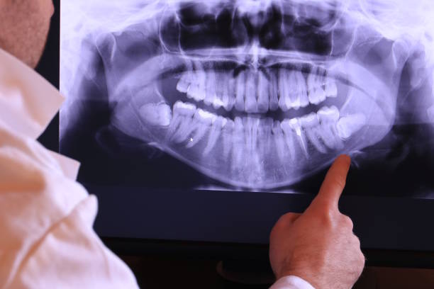 Best Emergency Denture Repair in Robertsville, NJ