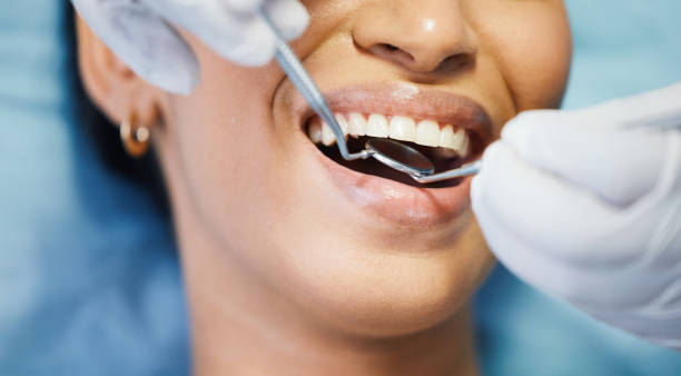 Best Emergency Tooth Extraction in Robertsville, NJ